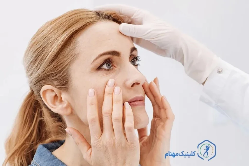 تمرینات چشم برای فلج بلز